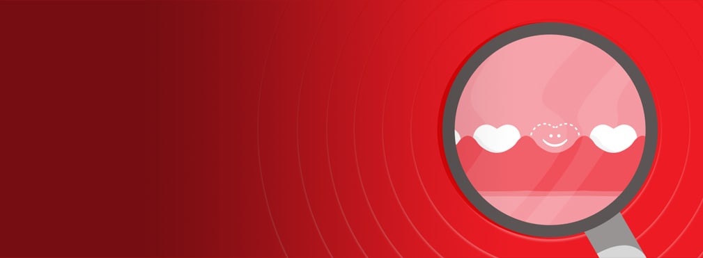 manglende tann i munnen